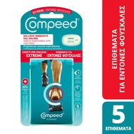 Compeed Extreme Medium Patches 5 Броя - Средни Пластири, Създадени за Особено Болезнени Мехури & Незабавно Облекчение от Болката Compeed Extreme Medium Patches 5 Броя - Средни Пластири, Създадени за Особено Болезнени Мехури & Незабавно Облекчение от Болката