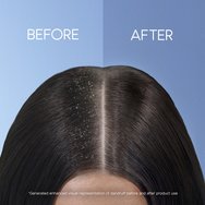 Head & Shoulders Dry Scalp Care Anti-Dandruff Shampoo 360ml