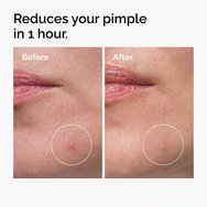 The Ordinary Sulfur 10% Powder-to-Cream Concentrate 5g