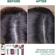 Klorane Promo Strength & Vitality Hair & Nails Keratin 90caps (3x30caps)