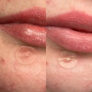 Hero. Invisible+ Mighty Patch 24 бр