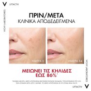 Vichy Liftactiv Specialist B3 Serum for Dark Spots & Wrinkles 30ml Vichy Liftactiv Specialist B3 Serum for Dark Spots & Wrinkles 30ml