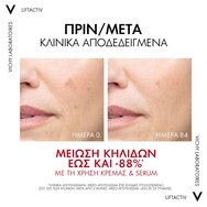 Vichy Liftactiv B3 Pigment Specialist Day Cream Spf50, 50ml Vichy Liftactiv B3 Pigment Specialist Day Cream Spf50, 50ml