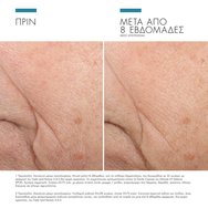 Skinceuticals Triple Lipid Restore 2 : 4 : 2 Anti-Aging Lipid Replenishing Cream 48ml