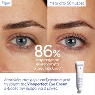 Caudalie Vinoperfect Brightening Eye Cream 15ml