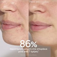 Caudalie Vinopure Blemish Control Salicylic Serum 30ml Caudalie Vinopure Blemish Control Salicylic Serum 30ml