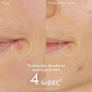 Caudalie Vinopure Salicylic Spot Solution 15ml Caudalie Vinopure Salicylic Spot Solution 15ml