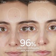 Caudalie Vinopure Promo Purifying Cleanser Gel 30ml & Toner 50ml & Blemish Control Salicylic Serum 10ml & Moisturizing Mattifying Fluid 15ml Caudalie Vinopure Promo Purifying Cleanser Gel 30ml & Toner 50ml & Blemish Control Salicylic Serum 10ml & Moisturizing Mattifying Fluid 15ml