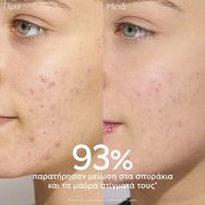 Caudalie Vinopure Promo Purifying Cleanser Gel 30ml & Toner 50ml & Blemish Control Salicylic Serum 10ml & Moisturizing Mattifying Fluid 15ml Caudalie Vinopure Promo Purifying Cleanser Gel 30ml & Toner 50ml & Blemish Control Salicylic Serum 10ml & Moisturizing Mattifying Fluid 15ml