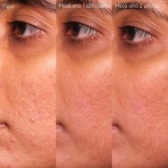 Caudalie Promo Vinopure Blemish Control Salicylic Serum 30ml & Подарък Purifying Toner 200ml