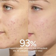 Caudalie Vinopure Moisturizing Mattifying Fluid 60ml Caudalie Vinopure Moisturizing Mattifying Fluid 60ml