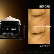 Filorga Global Repair Advanced Eyes & Lips Крем за очи & устни с интензивно подхранване, подходящ при загуба на стегнатост, фини линии & бръчки 15ml