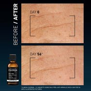 Filorga Daily Peel Anti-Wrinkle Resurfacing Solution Serum Грижа за ежедневна ексфолиация против бръчки, за подобряване на текстурата & възстановяване на сиянието на кожата 50ml Filorga Daily Peel Anti-Wrinkle Resurfacing Solution Serum Грижа за ежедневна ексфолиация против бръчки, за подобряване на текстурата & възстановяване на сиянието на кожата 50ml