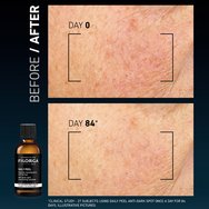 Filorga Daily Peel Anti-Dark Spot Resurfacing Solution Serum 50ml Filorga Daily Peel Anti-Dark Spot Resurfacing Solution Serum 50ml