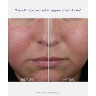Neostrata Clarify Mandelic Clarifying Hydragel 50ml Neostrata Clarify Mandelic Clarifying Hydragel 50ml