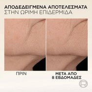 L\'Oreal Paris Age Perfect Micro-Collagen Anti-Sagging Firming Serum Стягащ серум за лице с пептиди микро-колаген & ниацинамид 30ml