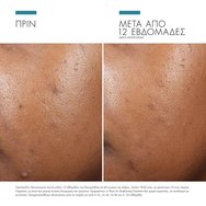 Skinceuticals Phyto A+ Brightening Treatment Cream 30ml