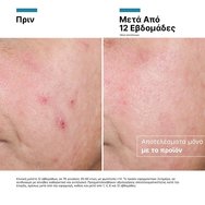 Skinceuticals Advanced RGN-6 Cream 50ml