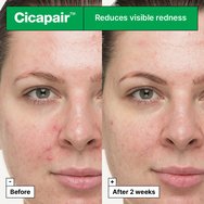 Dr.Jart+ Cicapair So Soothing Treatment for Visibly Irritated Skin 30ml