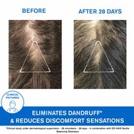 Uriage DS Hair Anti-Dandruff Treatment Shampoo 200ml Uriage DS Hair Anti-Dandruff Treatment Shampoo 200ml