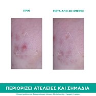 Uriage Hyseac 3-Regul+ Anti-Blemish Global Care 40ml Uriage Hyseac 3-Regul+ Anti-Blemish Global Care 40ml
