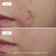 Novexpert Trio-Zinc Booster Serum 30ml Novexpert Trio-Zinc Booster Serum 30ml
