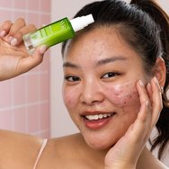 SVR Sebiaclear Global Corrector Serum Серум за лице против несъвършенства и бръчки за кожа, склонна към акне, с 14% глюконолактон и 4% ниацинамид 30ml