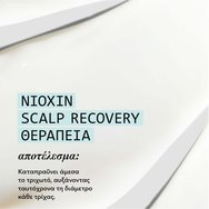 Nioxin Scalp Recovery Anti-Dandruff Soothing Cream 100ml