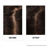 Nioxin Hair Fall Defense Shampoo Шампоан против косопад, който премахва замърсяванията и осигурява по-силна коса от корена 475ml