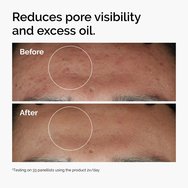 The Ordinary Niacinamide 10% + Zinc 1% Face Serum 30ml The Ordinary Niacinamide 10% + Zinc 1% Face Serum 30ml