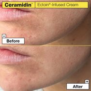 Dr.Jart+ Ceramidin Ectoin-Infused Cream for Dry Skin 50ml