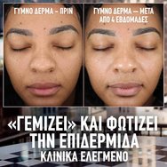 Maybelline Lifter Plump & Glow Spf15 Foundation Хидратиращ фон дьо тен със средна защита, 2% ниацинамид и хиалуронова киселина за плътен и сияен вид през целия ден 30ml - 355