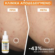 Garnier Promo Skinactive Vitamin C Glow Booster 30ml & Brightening Over Make Up Invisible UV Mist Spf50+, 75ml Garnier Promo Skinactive Vitamin C Glow Booster 30ml & Brightening Over Make Up Invisible UV Mist Spf50+, 75ml