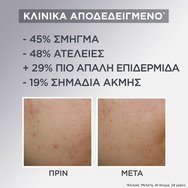 Garnier Promo Skinactive Daily Mattifying 3in1 Air Cream 50ml & Anti-Imperfection Serum 30ml & Invisible Pimple Patch 22 бр Garnier Promo Skinactive Daily Mattifying 3in1 Air Cream 50ml & Anti-Imperfection Serum 30ml & Invisible Pimple Patch 22 бр