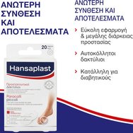 Hansaplast Pressure relief Rings Защитни Пръстени за Защита на Мазоли, Втвърдявания & Чувствителни Зони 20 Броя Hansaplast Pressure relief Rings Защитни Пръстени за Защита на Мазоли, Втвърдявания & Чувствителни Зони 20 Броя
