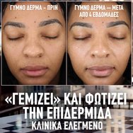 Maybelline Lifter Plump & Glow Spf15 Foundation Хидратиращ Фон дьо тен със Средна Защита, 2% Ниацинамид & Хиалуронова Киселина за Плътна & Сияйна Кожа през Целия Ден 30ml - 117 Maybelline Lifter Plump & Glow Spf15 Foundation Хидратиращ Фон дьо тен със Средна Защита, 2% Ниацинамид & Хиалуронова Киселина за Плътна & Сияйна Кожа през Целия Ден 30ml - 117