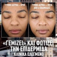 Maybelline Lifter Plump & Glow Spf15 Foundation Хидратиращ Фон дьо тен със Средна Защита, 2% Ниацинамид & Хиалуронова Киселина за Плътна & Сияйна Кожа през Целия Ден 30ml - 102