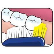 TePe Nova Soft Мека четка за зъби със специално проектирана глава за добър достъп, която не наранява 1 бройка