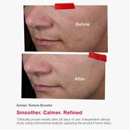 Skincode Essentials Azelaic Texture Booster 30ml Skincode Essentials Azelaic Texture Booster 30ml