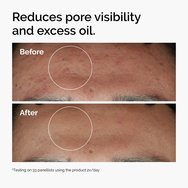 The Ordinary Niacinamide 10% + Zinc 1% 60ml  The Ordinary Niacinamide 10% + Zinc 1% 60ml