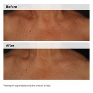 The Ordinary Niacinamide 5% Face & Body Emulsion 100ml The Ordinary Niacinamide 5% Face & Body Emulsion 100ml