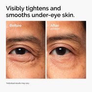 Lacto-PDRN* 4% + B9 Nourishing Eye Cream Подхранващ крем за околоочния контур, който стяга, хидратира & осигурява видим лифтинг ефект в зоната около очите 15ml Lacto-PDRN* 4% + B9 Nourishing Eye Cream Подхранващ крем за околоочния контур, който стяга, хидратира & осигурява видим лифтинг ефект в зоната около очите 15ml
