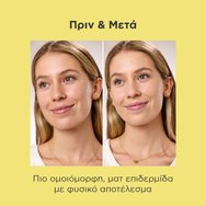 Isdin Acniben 2 Spf30 CC+ Cream Хидратиращ крем за лице с висока слънцезащита и цвят за мазна и склонна към акне кожа против несъвършенства 40ml - Light Isdin Acniben 2 Spf30 CC+ Cream Хидратиращ крем за лице с висока слънцезащита и цвят за мазна и склонна към акне кожа против несъвършенства 40ml - Light