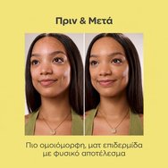 Isdin Acniben 2 Spf30 CC+ Cream Хидратиращ крем за лице с висока слънцезащита и цвят за мазна и склонна към акне кожа против несъвършенства 40ml - Bronze