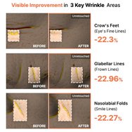 COSRX 5 PDRN Hyaluronic Acid Vital Hydrating Hydrogel Mask 1 бр COSRX 5 PDRN Hyaluronic Acid Vital Hydrating Hydrogel Mask 1 бр