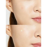 COSRX Master Patch Original Fit Anti-Imprefection Face Patches 24 бр COSRX Master Patch Original Fit Anti-Imprefection Face Patches 24 бр