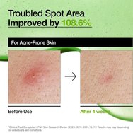 Anua Azelaic Acid 10+ Hyaluron Redness Soothing Serum Успокояващ серум за лице, подходящ за чувствителна кожа срещу зачервяване, възпаления & акне 30ml Anua Azelaic Acid 10+ Hyaluron Redness Soothing Serum Успокояващ серум за лице, подходящ за чувствителна кожа срещу зачервяване, възпаления & акне 30ml