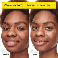 Dr.Jart+ Ceramidin Skin Barrier Cream for Dry Skin 15ml