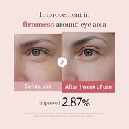 Medicube PDRN Pink Peptide Eye Cream Стягащ околоочен крем за бръчки & тъмни кръгове, подходящ за всички типове кожа 30ml