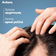 Ducray Anaphase Anti-Hair Loss Anti-Thinning Shampoo 400ml Ducray Anaphase Anti-Hair Loss Anti-Thinning Shampoo 400ml